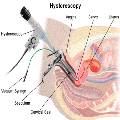 Laparoscopic Procedures